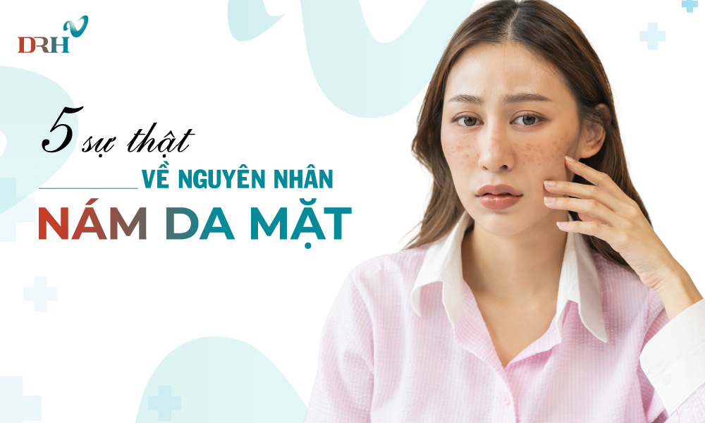nguyen-nhan-nam-da-mat