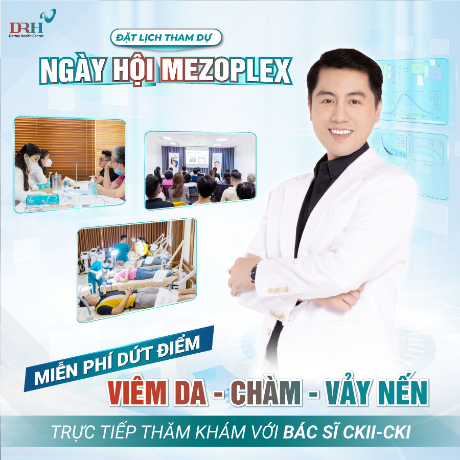 ngay-hoi-mezoplex-uu-dai-hot