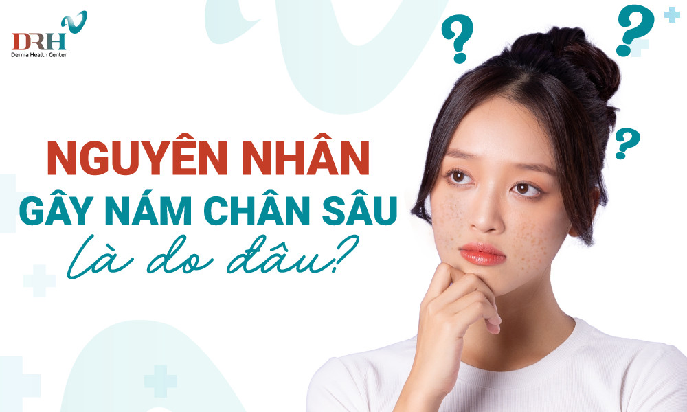 nguyen-nhan-gay-nam-chan-sau