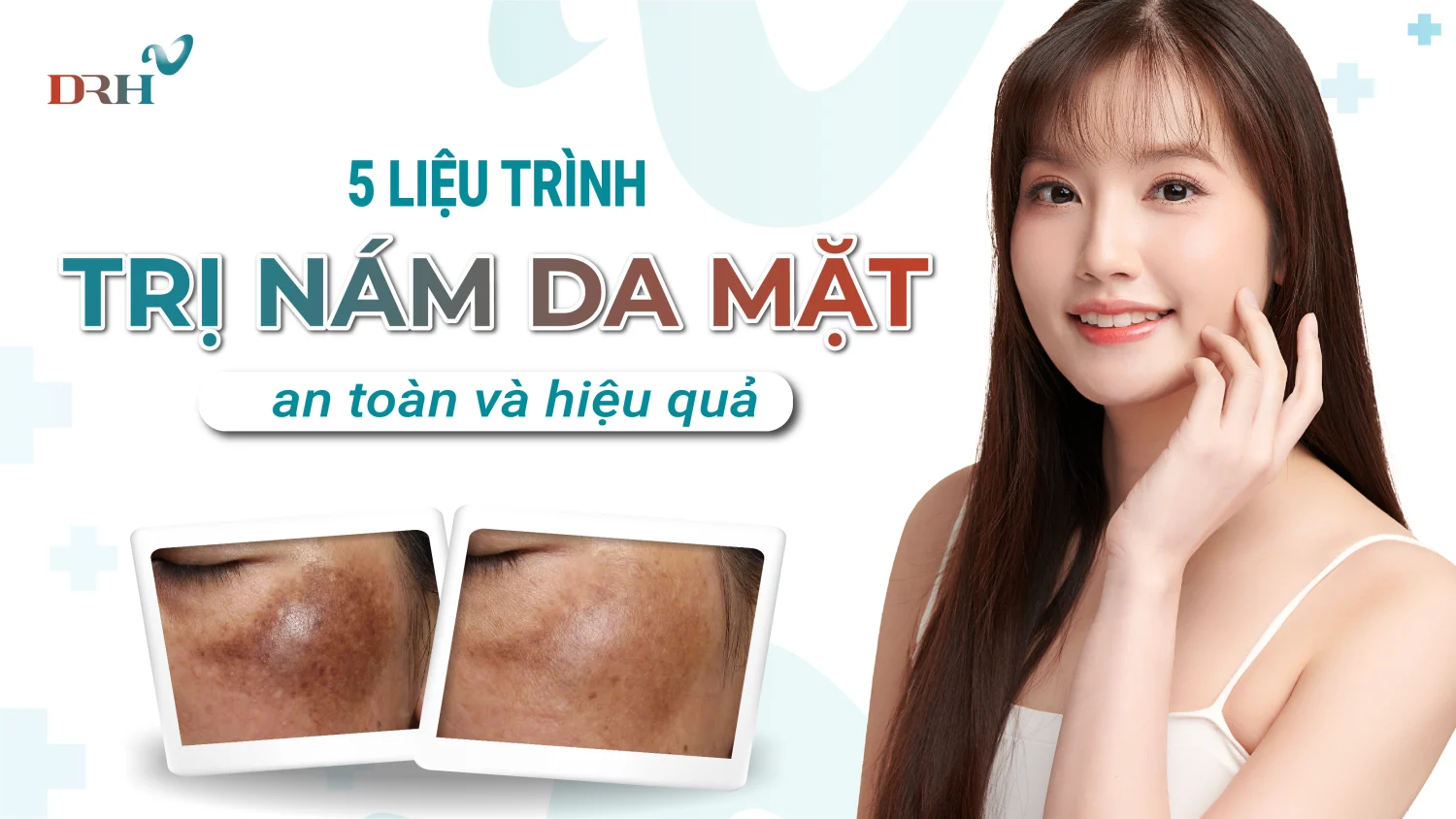 tri-nam-da-mat