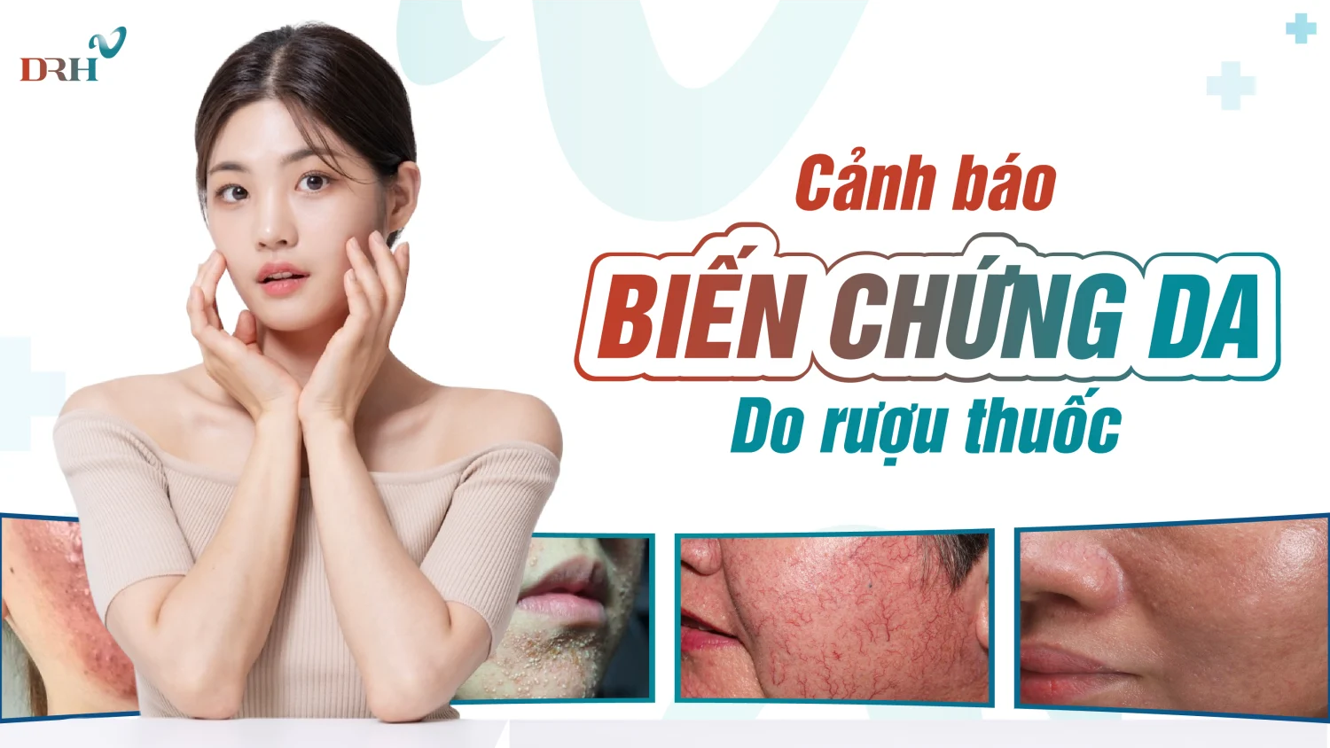 Điều trị nám da