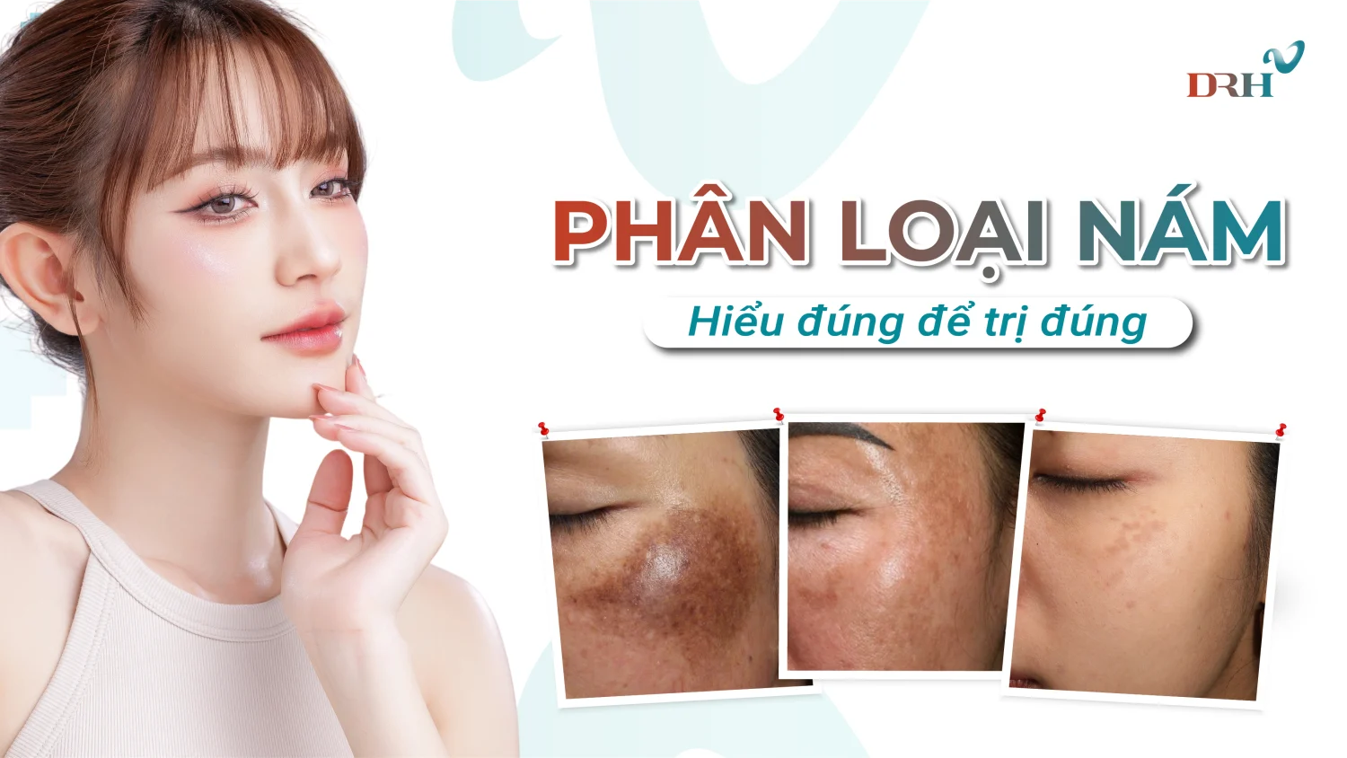 Phân loại nám