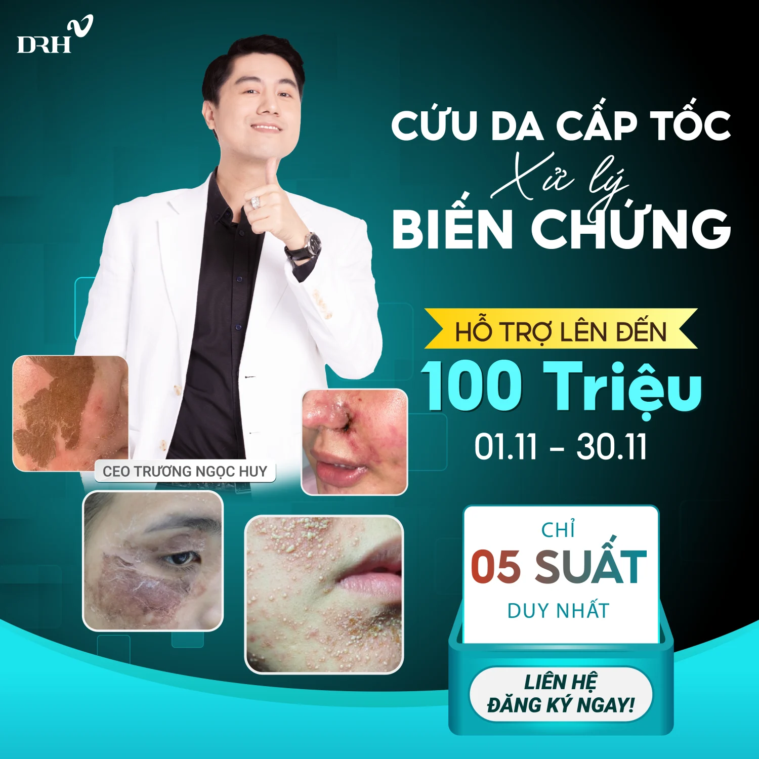 Cứu da cấp tốc - Ưu đãi hot