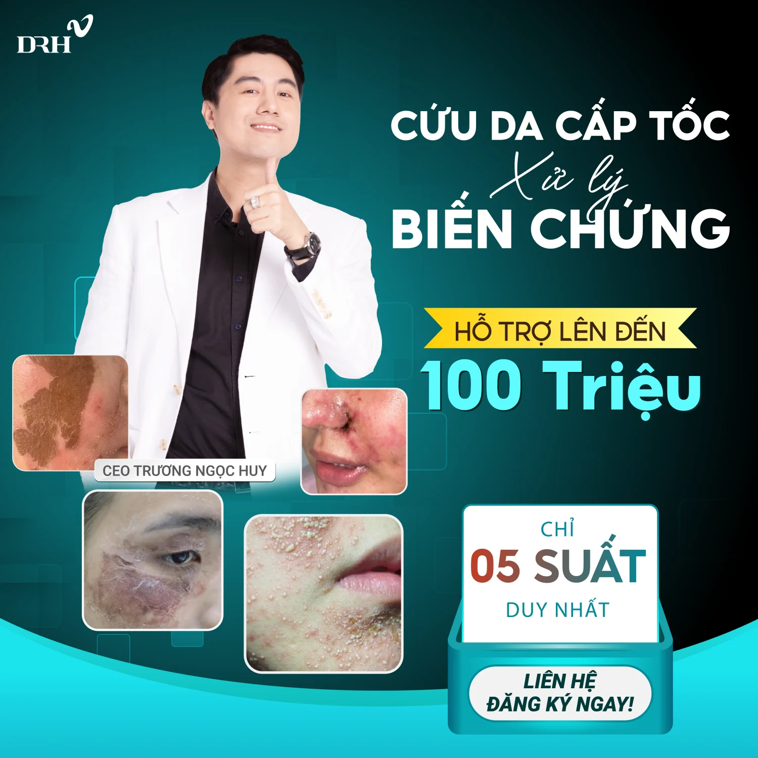 Cứu da cấp tốc - Ưu đãi hot