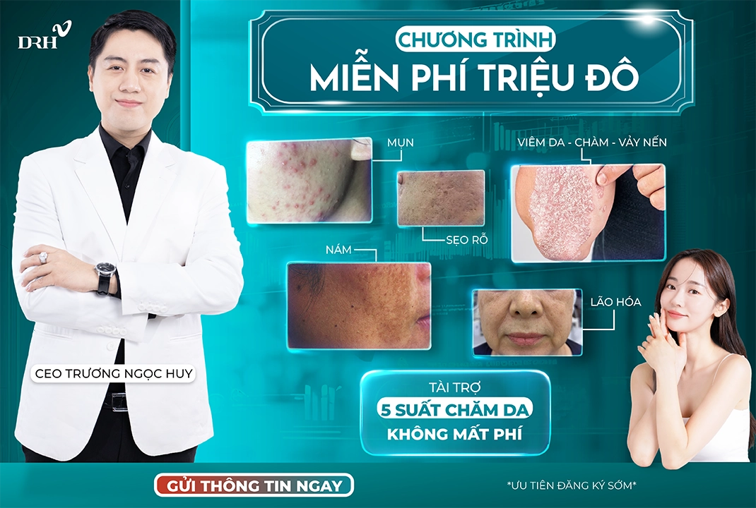 mien-phi-trieu-do-uu-dai-moi-nhat